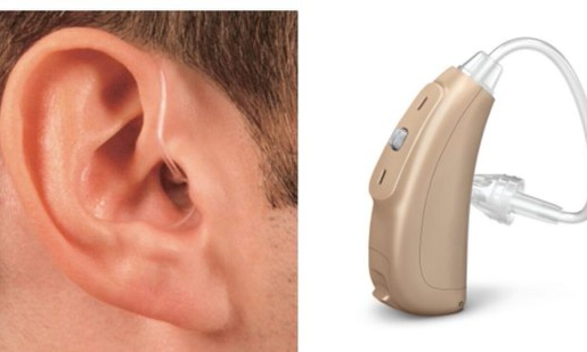 Как подобрать слуховой аппарат без врача. Слуховой аппарат Sivantos Siemens STF P t1. Слуховой аппарат лот 41319. Слуховой аппарат Sivantos STF P t3 Sivantos. Слуховой аппарат SN n8 72310.